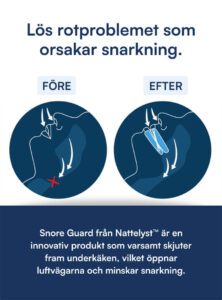 Snore Bundle
